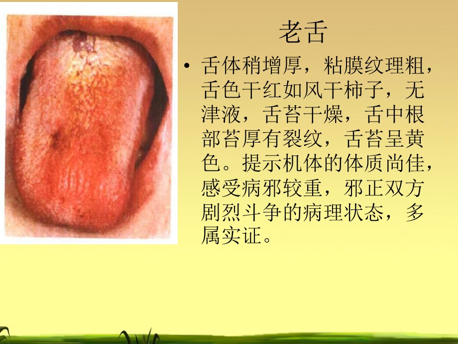 望舌识病图谱贵仔课件.ppt_第3页