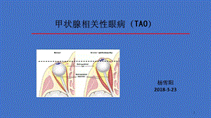 甲状腺相关性眼病课件.ppt