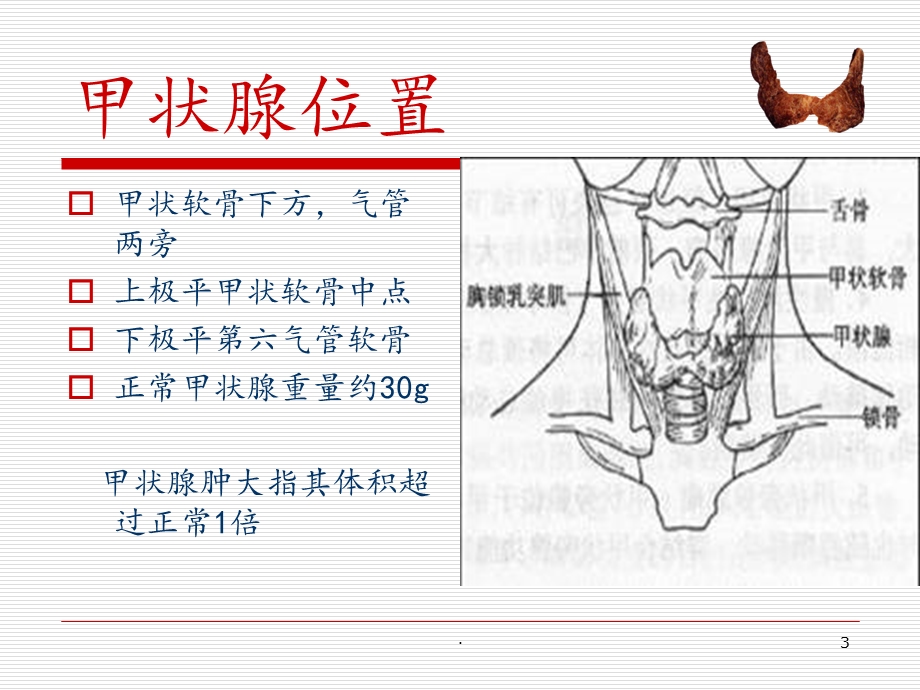 甲状腺肿瘤的护理课件.ppt_第3页