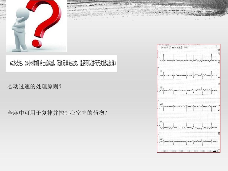 房颤病人的麻醉管理房颤病人麻醉管理指南课件.ppt_第3页