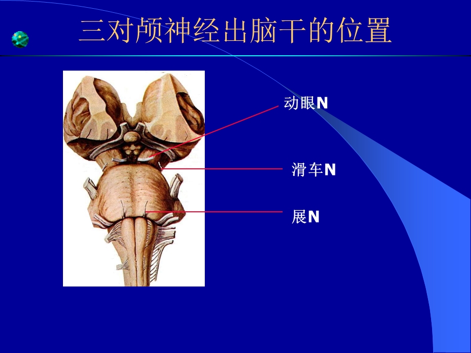 眼肌麻痹课件.ppt_第3页