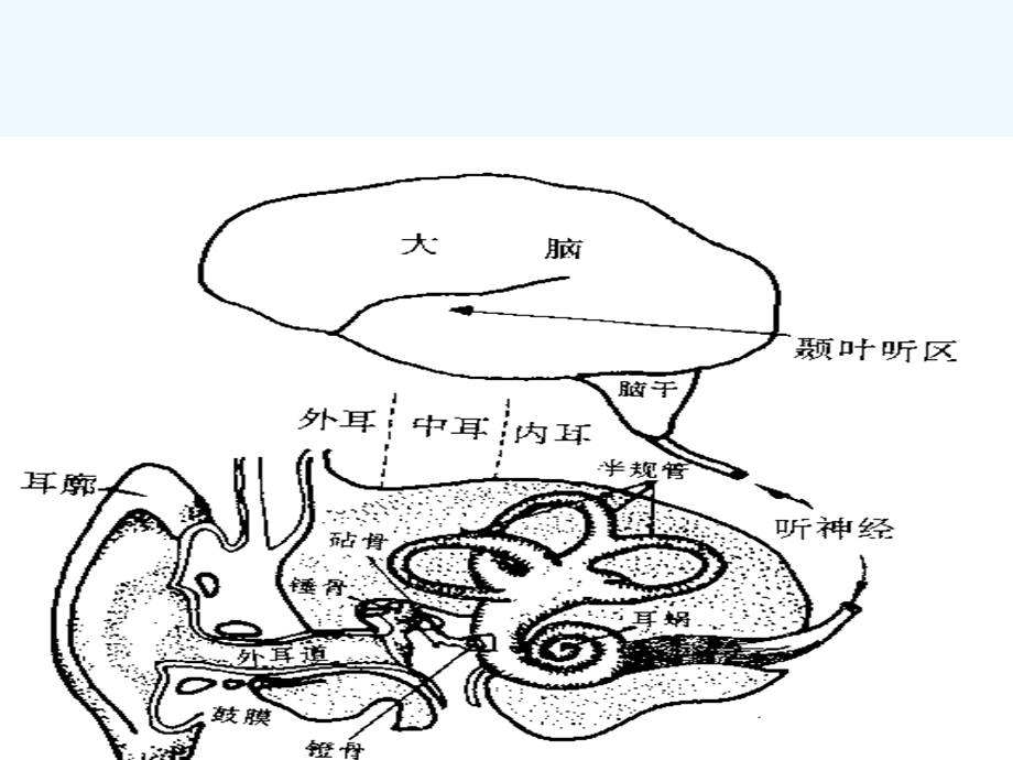 第三章听觉障碍课件.ppt_第3页