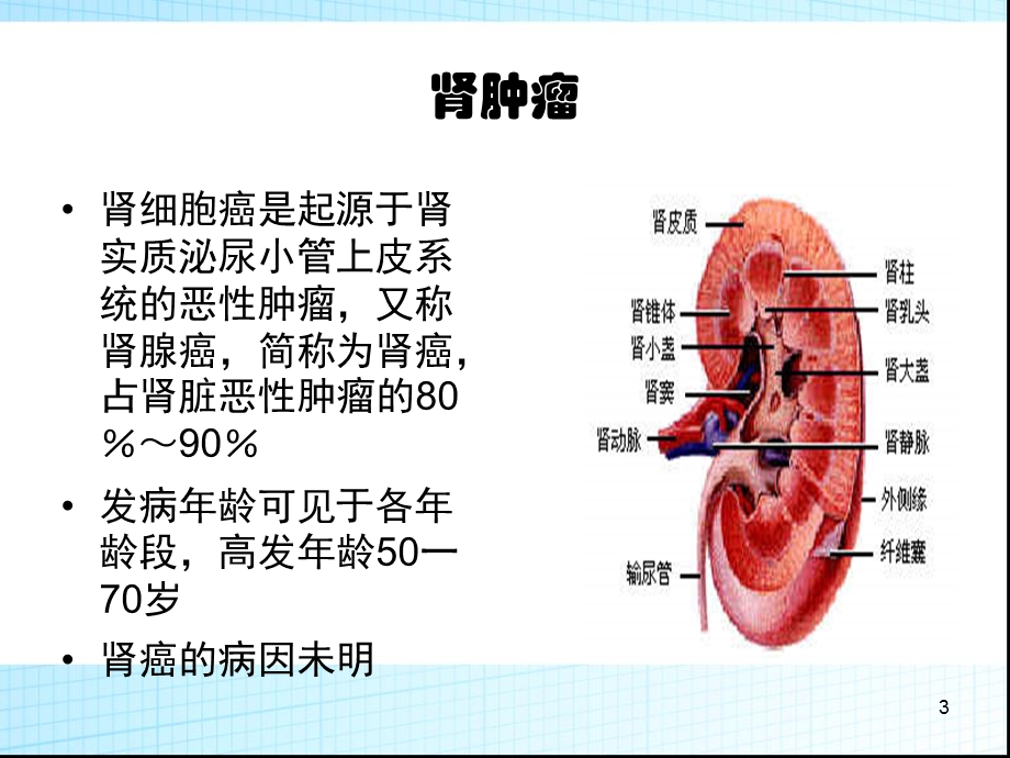 泌尿系统肿瘤课件.ppt_第3页