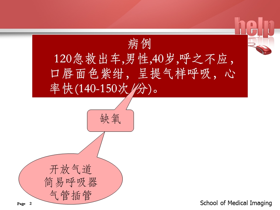 气管插管的医护配合课件.ppt_第2页