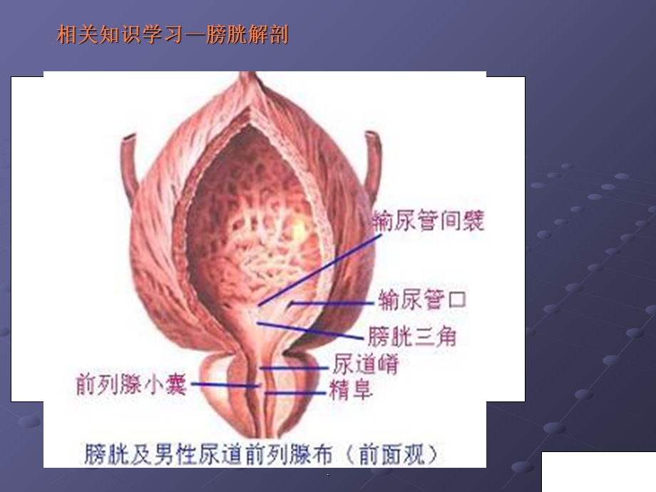 泌尿外科护理查房课件.ppt_第3页