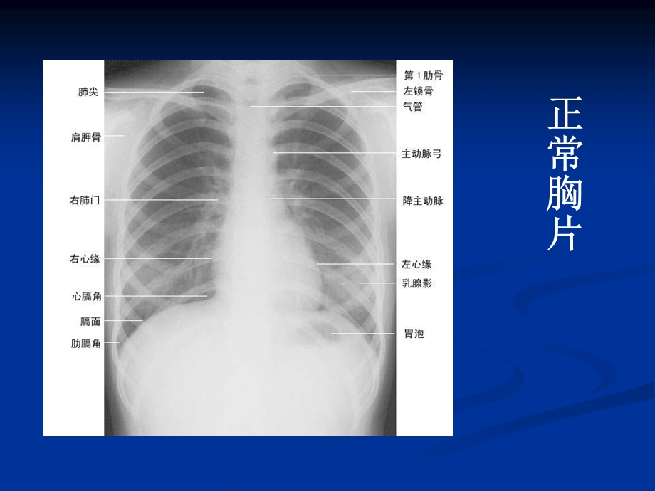 执业医师技能考试——X线课件.ppt_第2页