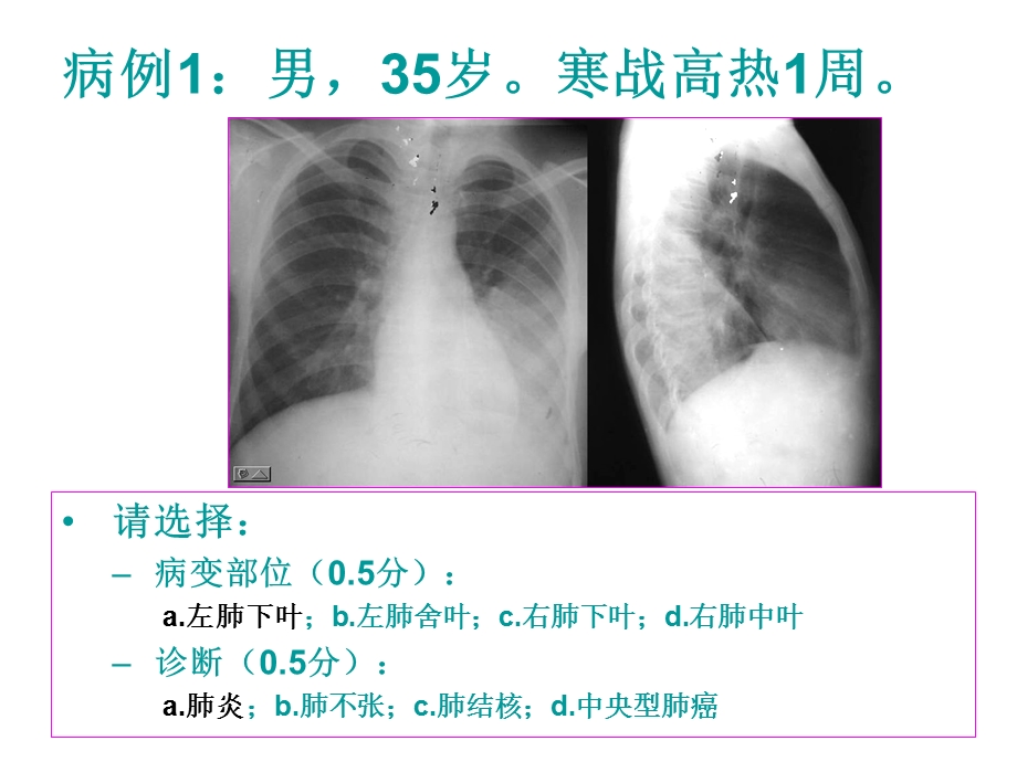 执业医师上机影像读片课件.ppt_第2页