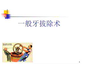 拔牙术课件.ppt