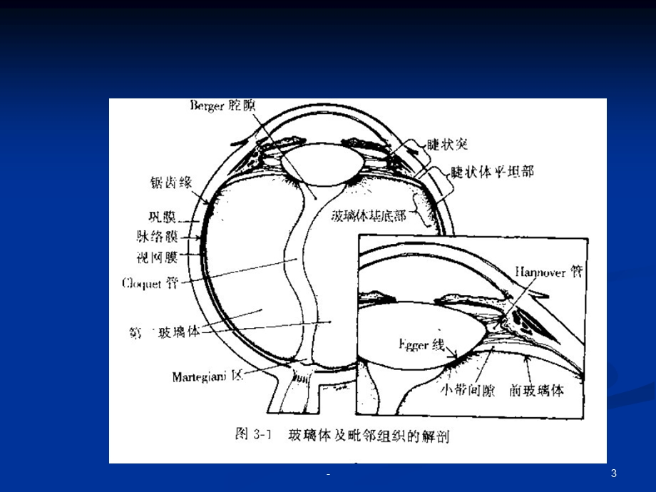 玻璃体积血课件.ppt_第3页