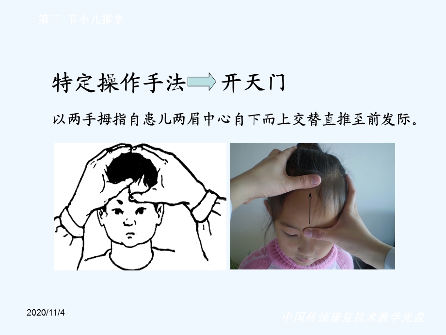 第三章推拿技术第三节小儿推拿课件.ppt_第3页