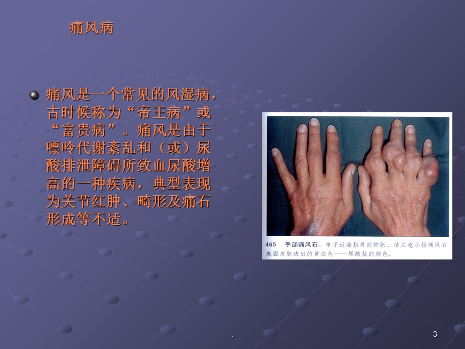 抗痛风药课件.ppt_第3页