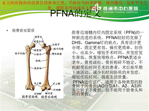 PFNA内固定术的医疗护理查房培训课件.ppt