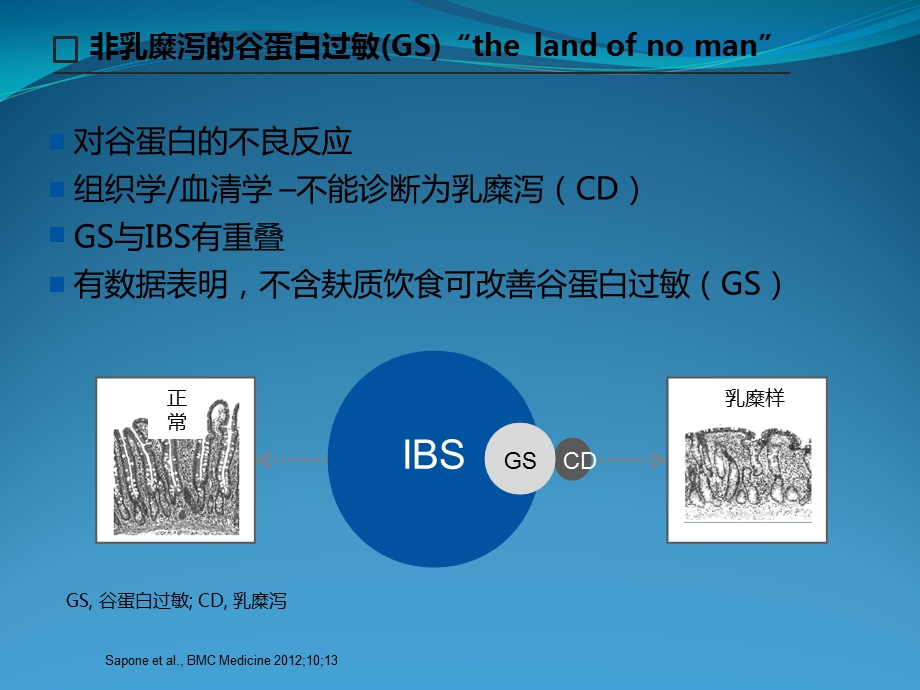 IBS病理生理机制研究进展课件.ppt_第3页