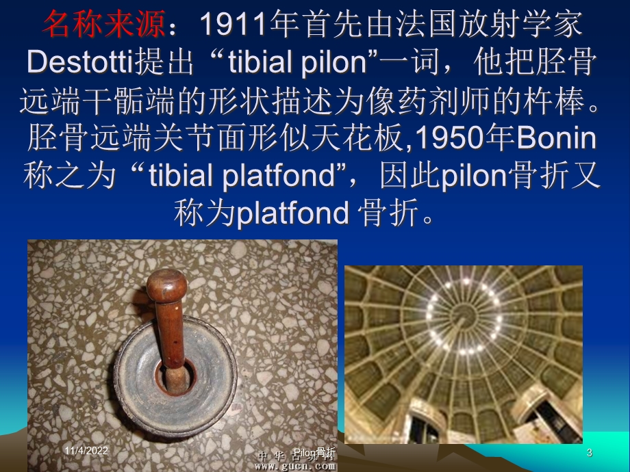 Pilon骨折培训课件.ppt_第3页