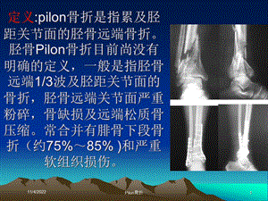 Pilon骨折培训课件.ppt