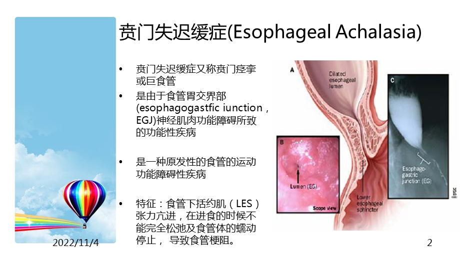 poem术的治疗与护理参考课件.ppt_第2页