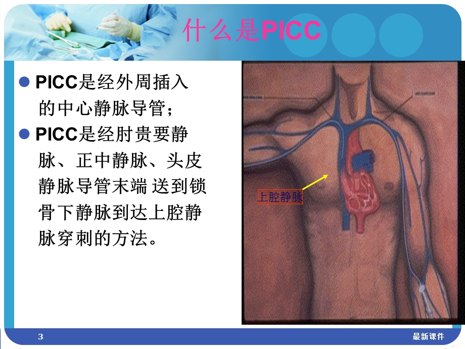 PICC置管与护理专业课件.ppt_第3页