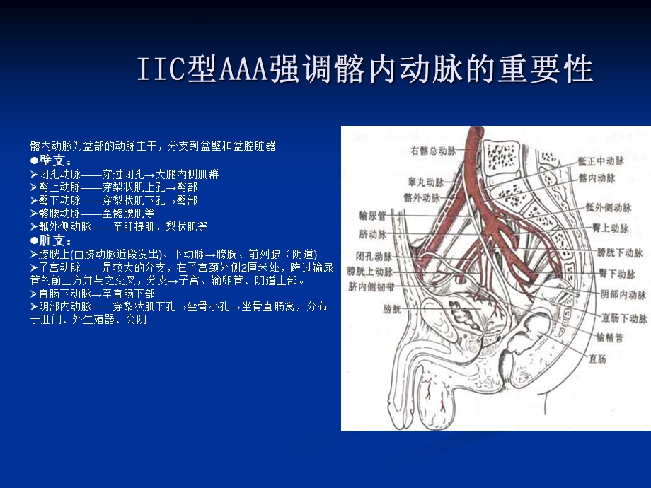 IIC腹主动脉瘤腔内修复中髂内动脉处理教案课件.pptx_第3页