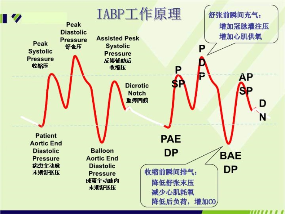 IABP在心脏危重症中的应用--课件.ppt_第3页