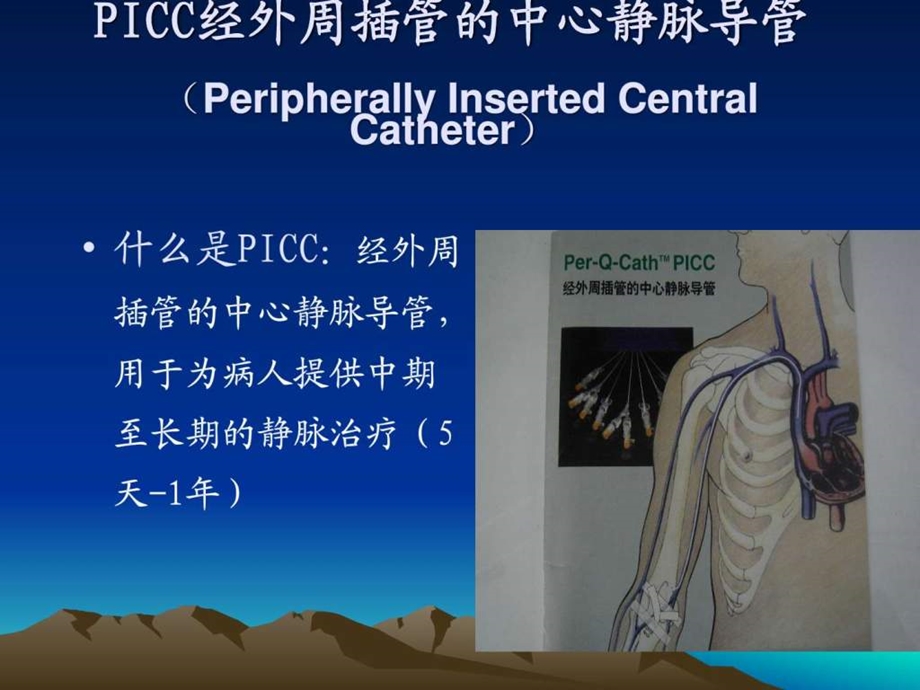 PICC置管术及护理(定稿)课件.ppt_第2页