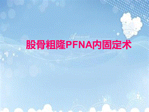 PFNA内固定术课件.ppt