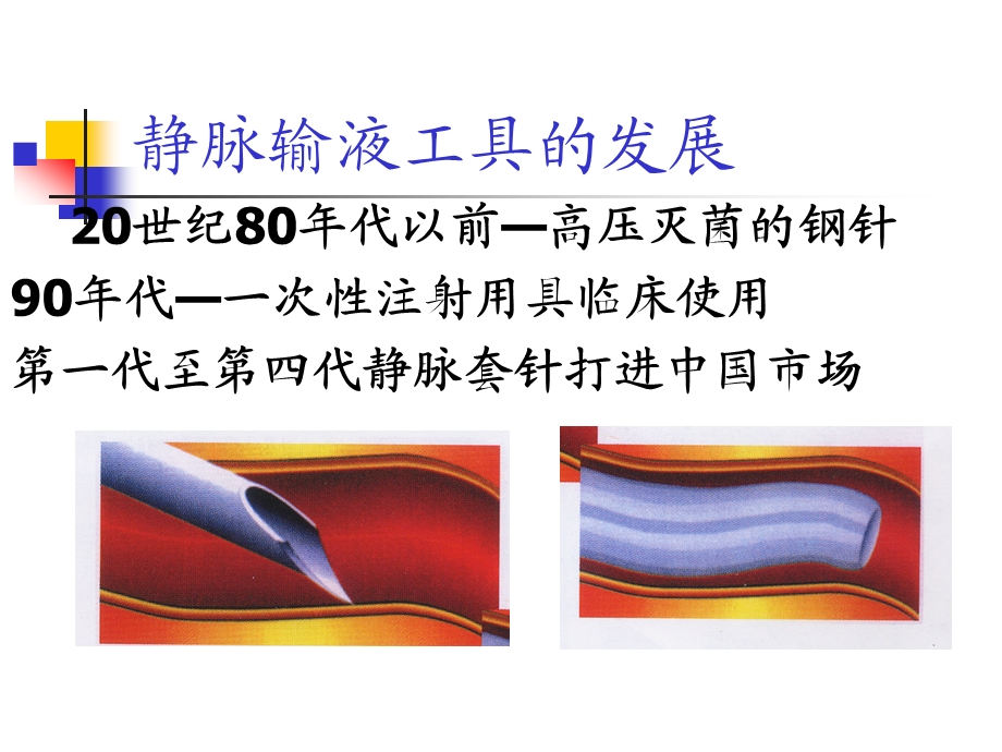 静脉输液工具合理选择ppt课件.ppt_第3页