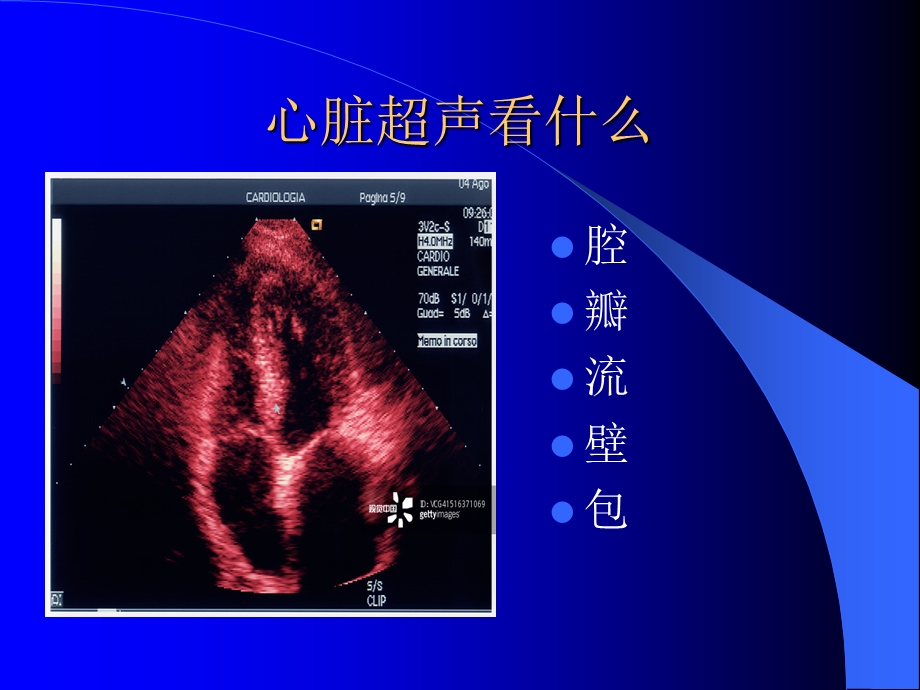 重症超声与血流动力学课件.ppt_第3页