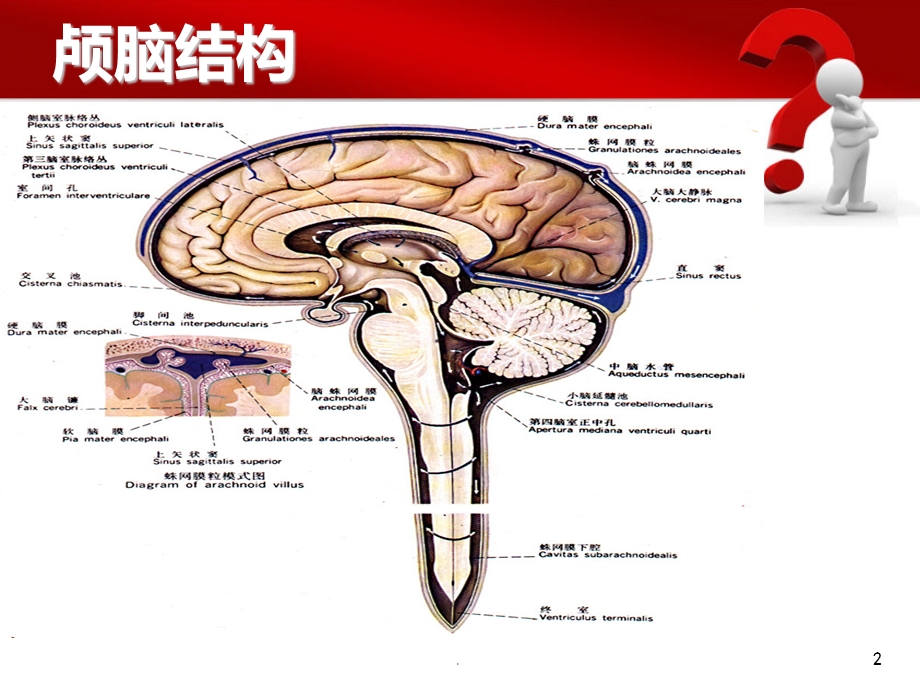 蛛网膜下腔出血的护理要点课件.ppt_第2页