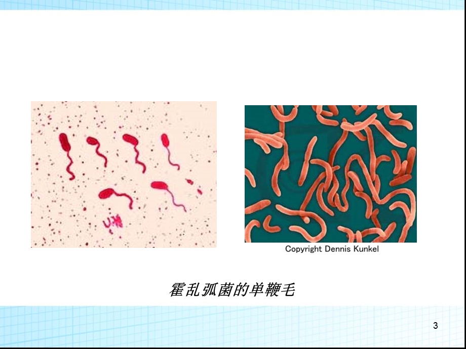 霍乱的护理课件.ppt_第3页