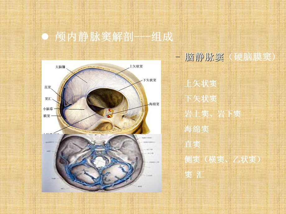 颅内静脉窦血栓形成的特点课件.pptx_第3页