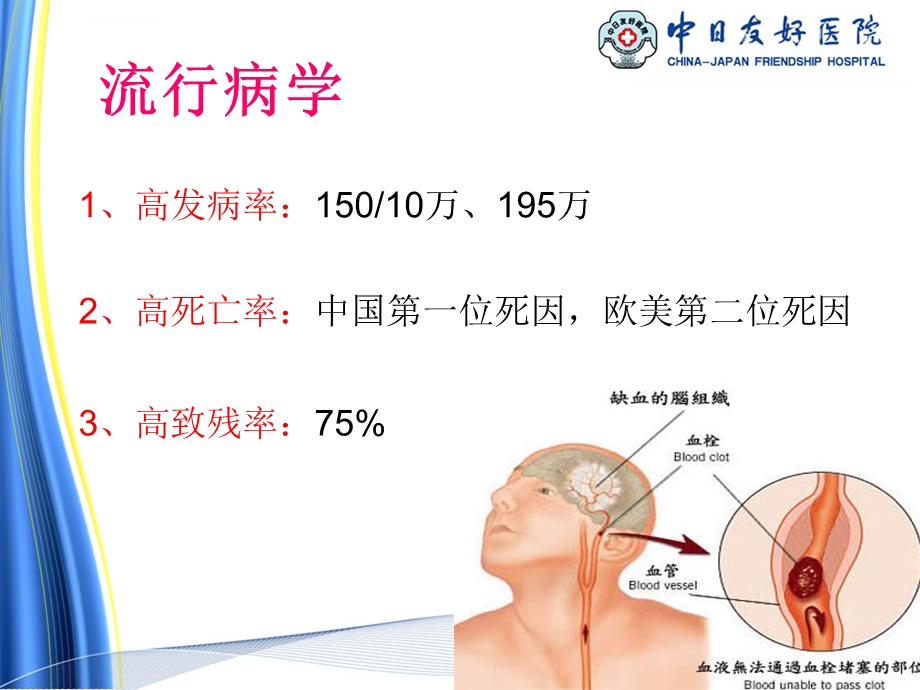 静脉溶栓护理ppt课件.ppt_第2页