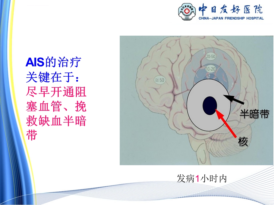 静脉溶栓护理ppt课件.ppt_第3页