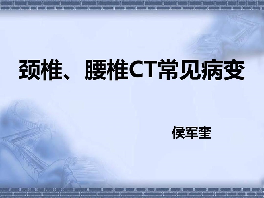 颈椎腰椎CT常见病变学习资料课件.ppt_第2页