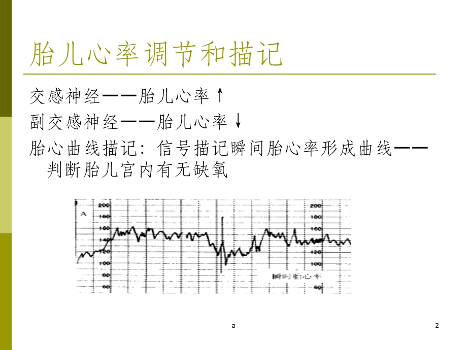 胎心监护及判读课件.ppt_第2页