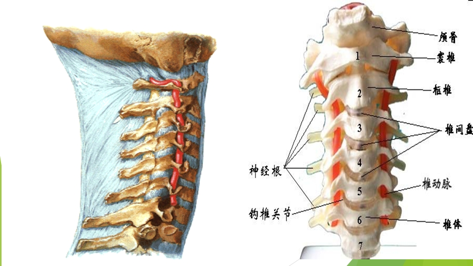 脊髓型颈椎病患者的个案护理查房课件.ppt_第2页