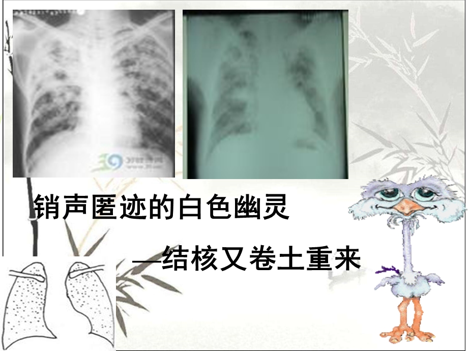 药理学抗结核药物课件.ppt_第2页