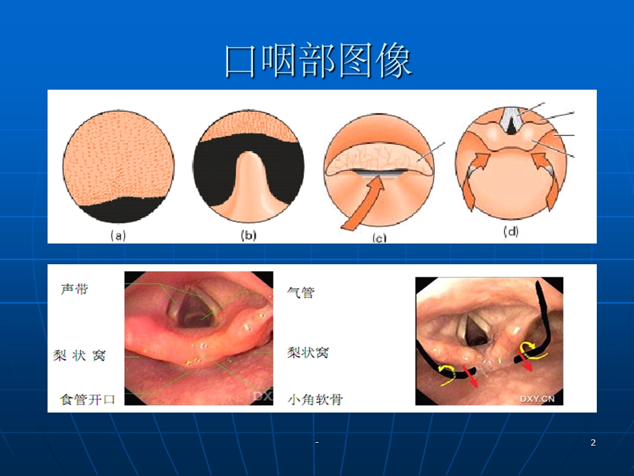 胃镜检查图解课件.ppt_第2页