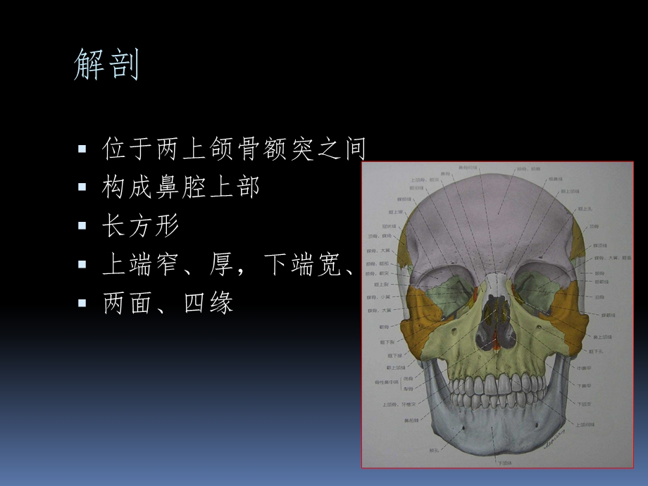 鼻骨骨折影像鉴别诊断课件.ppt_第2页