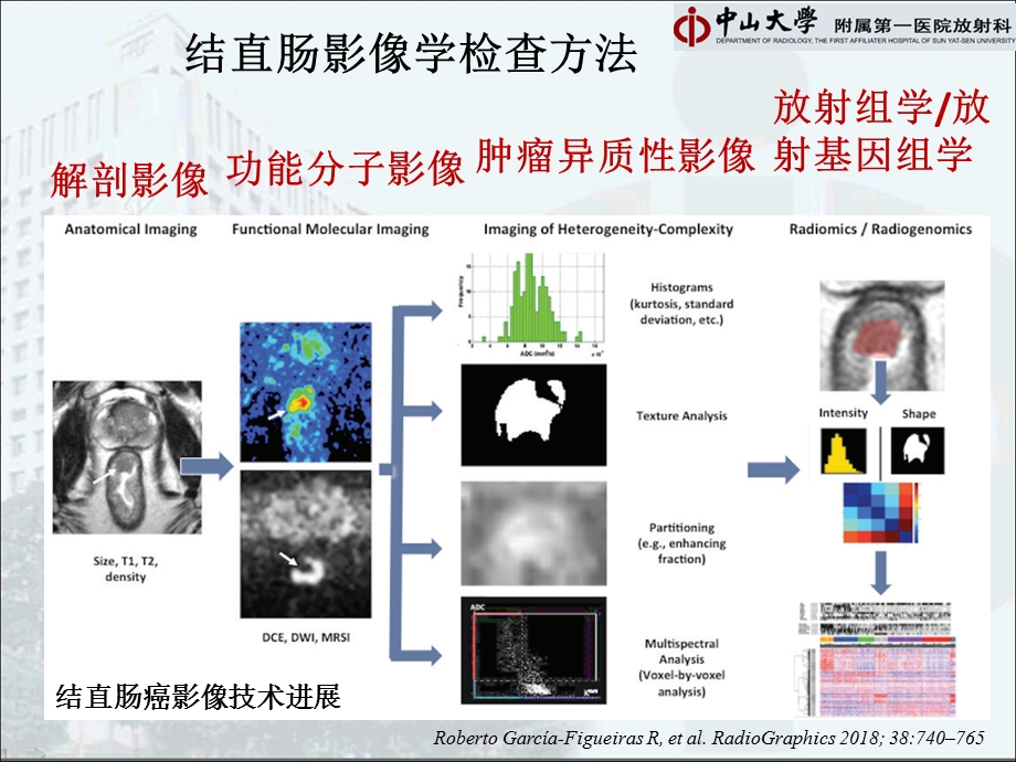 结直肠肿瘤的影像学诊断课件.pptx_第3页