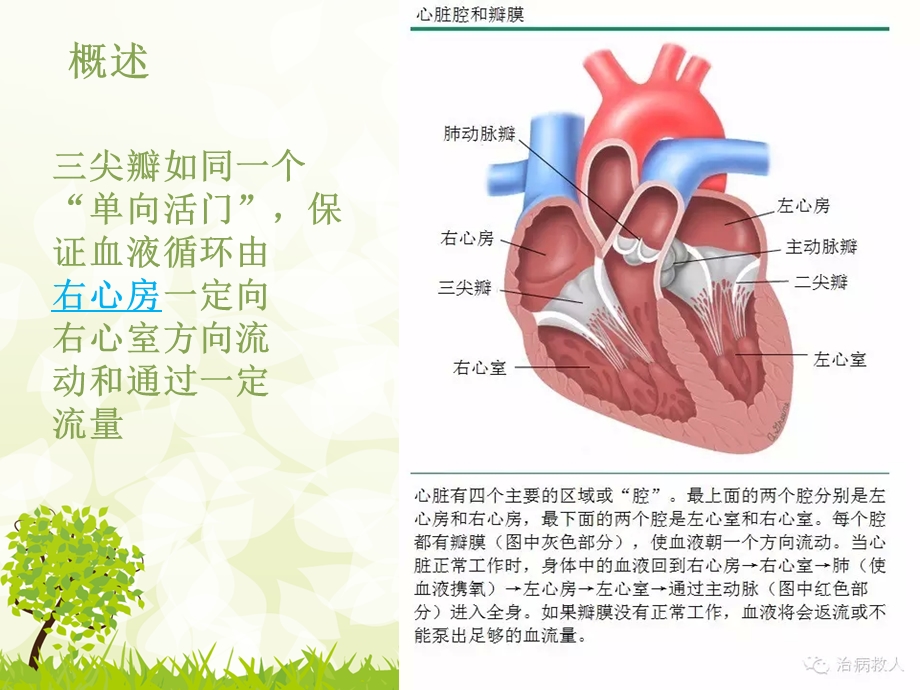 胸腔镜三尖瓣置换术后护理查房课件.ppt_第3页