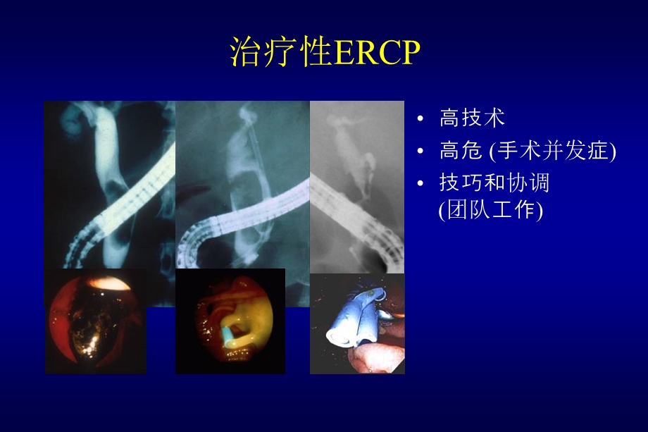 ERCP规范化培训课件.ppt_第2页