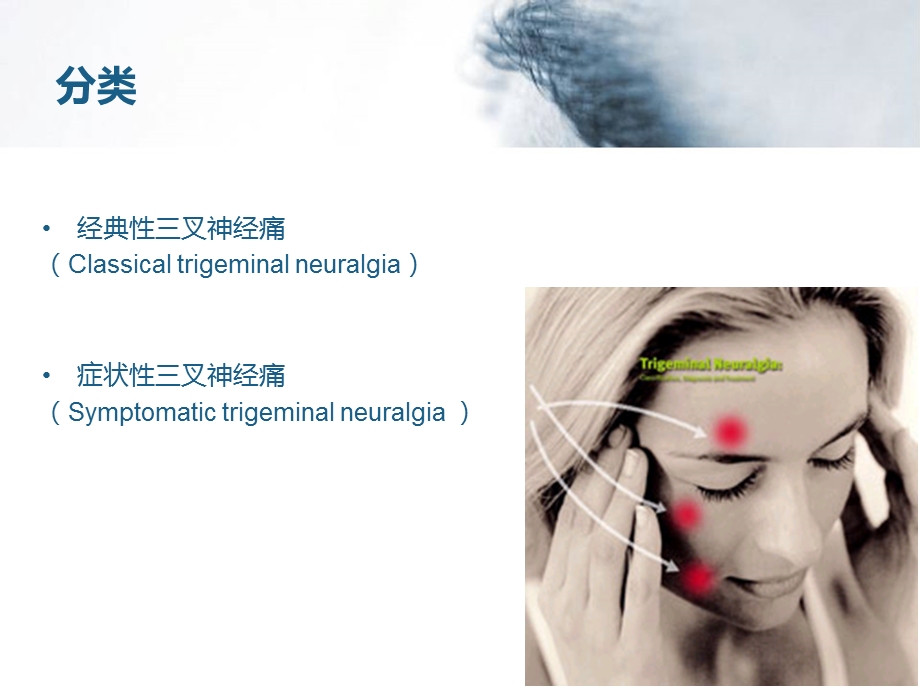 三叉神经痛课件ppt.ppt_第2页