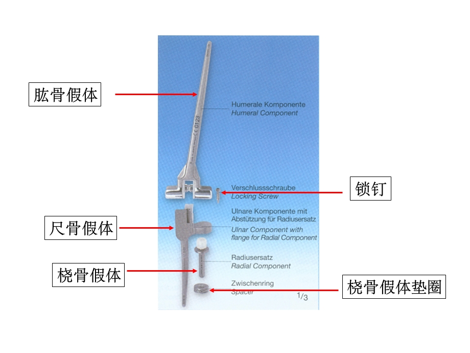 肘关节置换课件.ppt_第2页