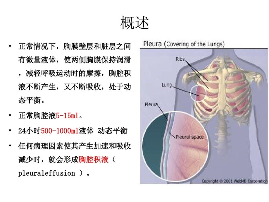 胸腔积液鉴别诊断课件.ppt_第2页