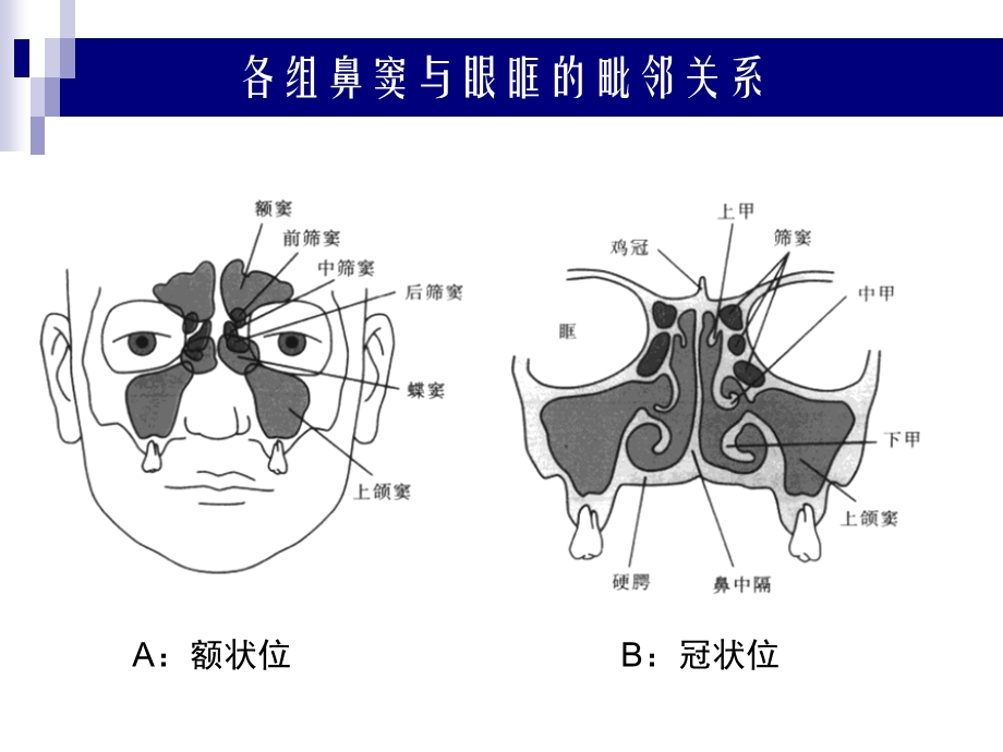 鼻、鼻窦和头颈部肿瘤的麻醉处理课件.ppt_第3页