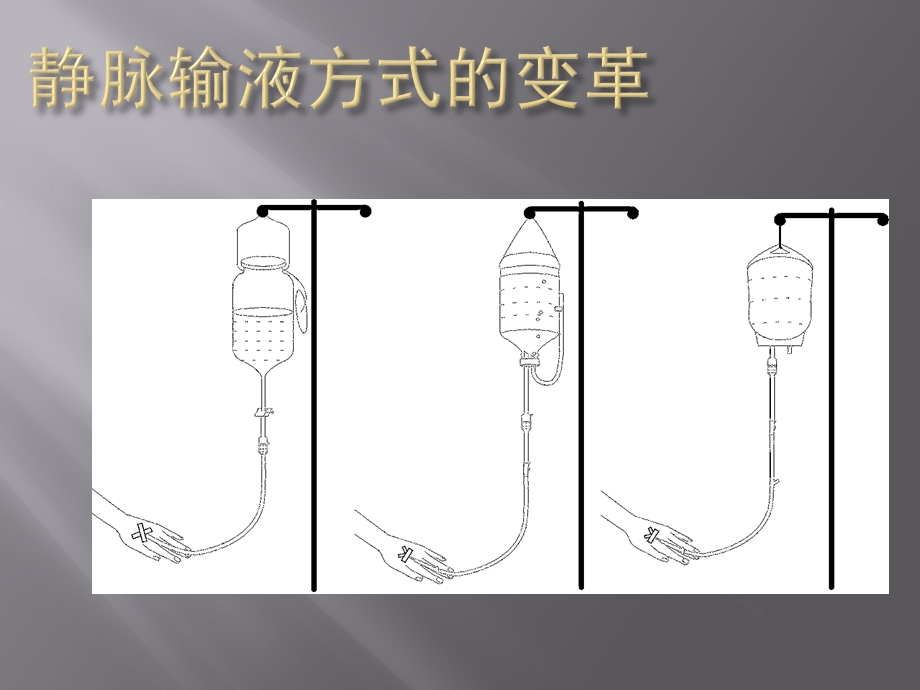 静脉输液安全课件.ppt_第3页