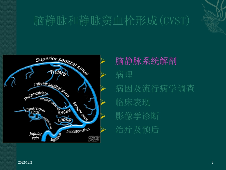 颅内静脉窦血栓形成课件.ppt_第2页