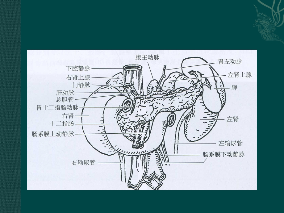 胰腺假性囊肿课件.ppt_第3页