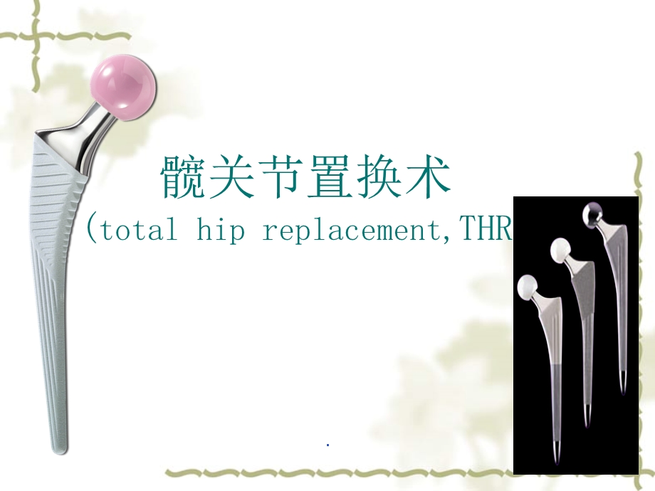 髋关节置换课件ppt.ppt_第3页