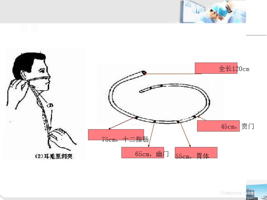 肠内营养课件.ppt_第3页